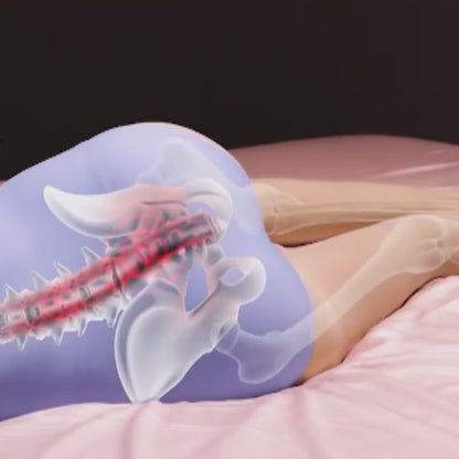 KneeAlign™ - Almohada Ergonómica para Piernas